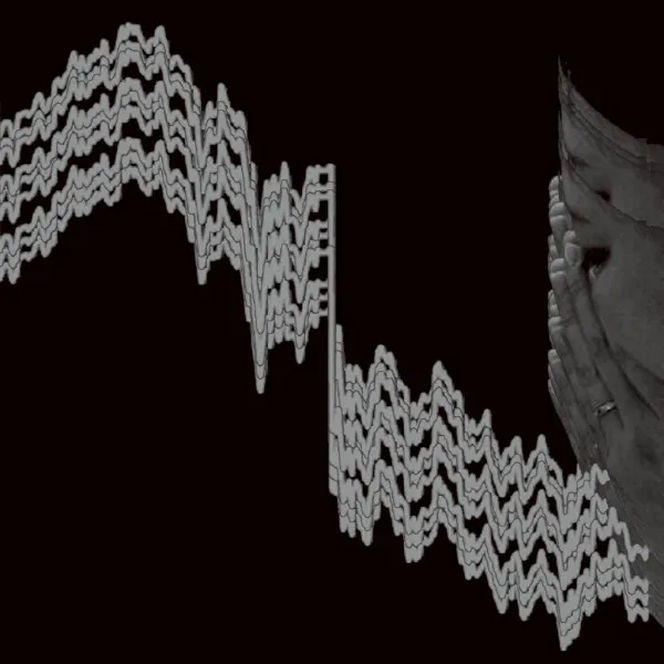 album_cover_image